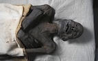 mummies disease